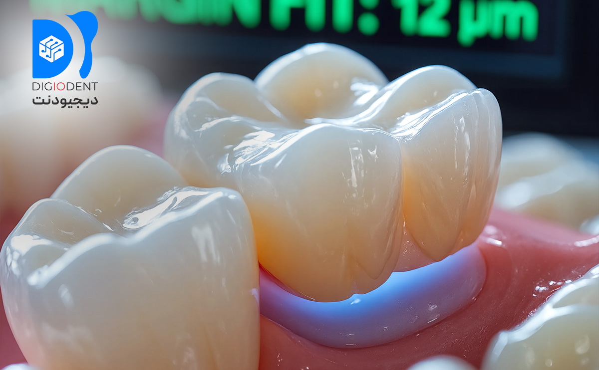 مارجینال فیت، نقطه تلاقی نهایی تمام تصمیمات فناوری در گردش‌کار دیجیتال دندانپزشکی است.